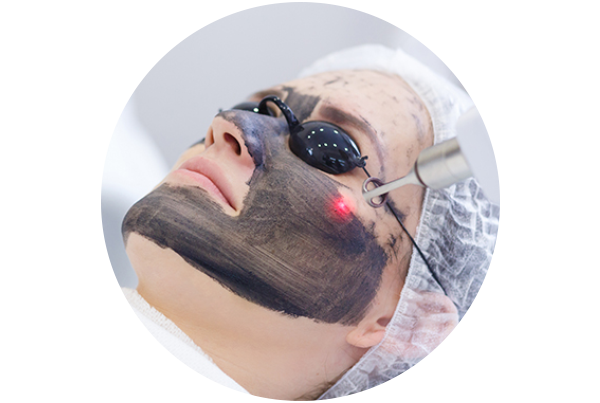 Carbon Peel Medifacial