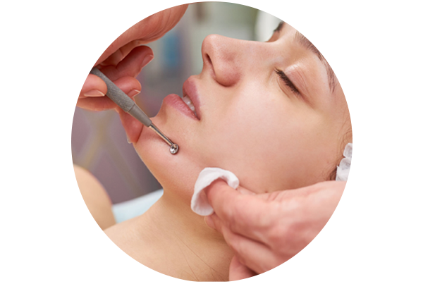 Extraction Medifacial