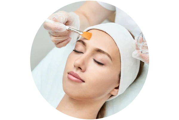 Chemical Peel