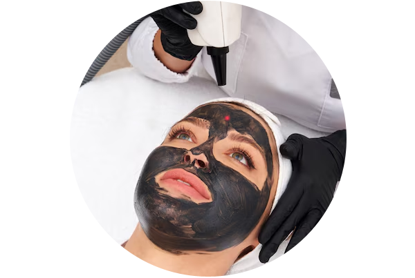 Charcoal Black Laser Treatment